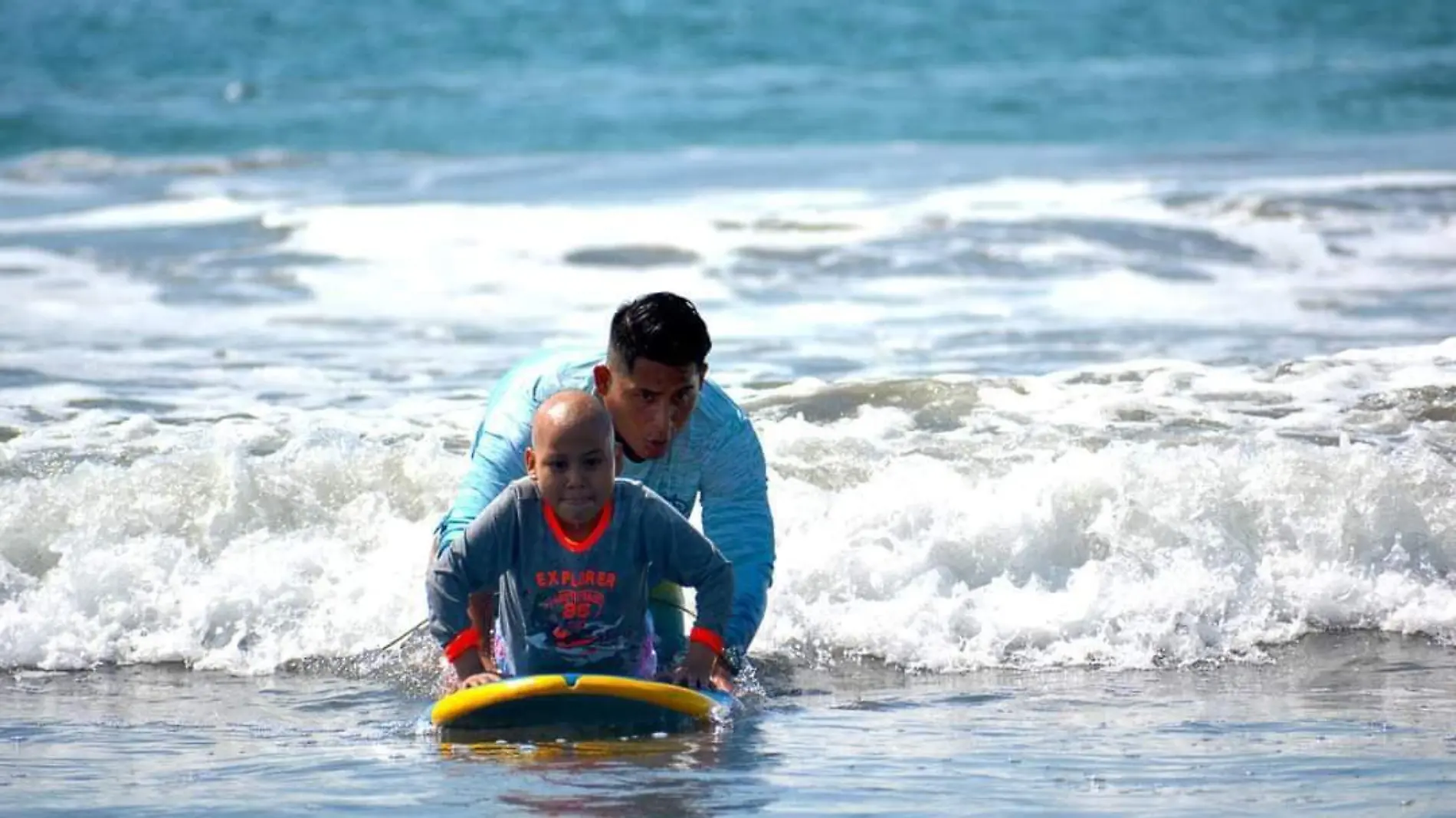 oncosurf 